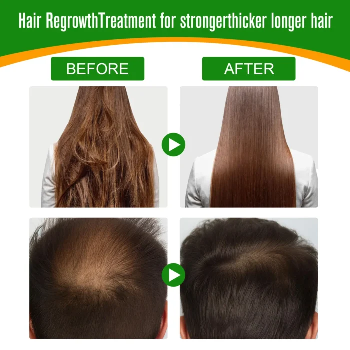 Natural Anti Loss Hair Regrowth Batana Oil 60ml -ALIVER - before after hair growth of men and women