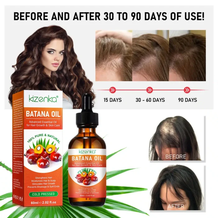 Cold Pressed Honduras Batana Oil for Hair Growth 60ml - Kizenka - 3 month growth progress before after