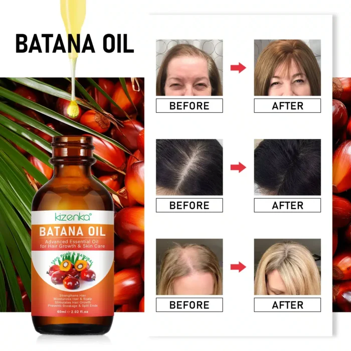 Cold Pressed Honduras Batana Oil for Hair Growth 60ml - Kizenka before after