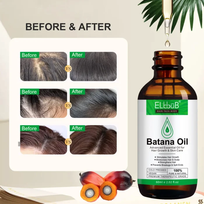 Advanced Essential Organic Batana Oil for Hair Growth 60ml - ELBBUB Before after