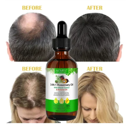 Hair Loss 3 In 1 Formula of Batana Oil + Rosemary Oil + Black Castor Oil before after